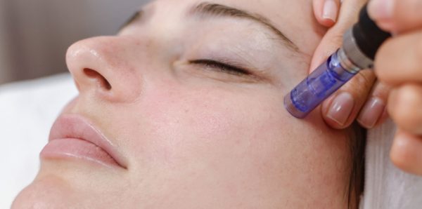 Skin rejuvenation with microneedle