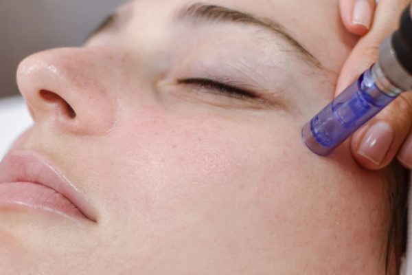 Skin rejuvenation with microneedle